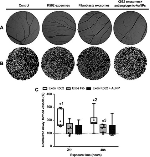 Figure 3 Aspect of the CAM areas treated for 24 hrs with phosphate buffer saline (PBS, control), Exosomes from K562 cells (50 µg/mL), Exosomes from fibroblasts (50 µg/mL), and a mixture of K562 exosomes (50 µg/mL) and 16.4 nM antiangiogenic-AuNPs. (A) Green channel images of the CAM region. (B) Respective segmented image used to calculate the number of branches. (C) Whiskers plots of the percentage of newly formed vessels obtained 24 and 48 hrs after exposure to Exosomes from K562 cells (50 µg/mL) (Exos K562, black bars with white filling); Exosomes from fibroblasts (50 µg/mL) (Exos Fib, gray bars with light gray filling); a mixture of K562 exosomes (50 µg/mL) and 16.4 nM antiangiogenic-AuNPs (Exos K562+ AuNP, black bars with dark gray filling). Bars represent the maximum, minimal, and mean of at least six independent experiments, represented as dots (Exos K562), squares (Exos Fib), or triangles (Exos K562+ AuNP) normalized to the number of tertiary venules obtained in the corresponding CAM area at 0 hrs incubation in the same embryo and to the number of venules obtained after exposure to PBS. Dotted line at 100% normalized newly formed vessels refers to the control sample – number of tertiary venules obtained after exposure to PBS and to the normalized number obtained in the corresponding CAM area at 0 hrs incubation. *1 p-value 0.0113, *2 p-value 0.0212, *3 p-value 0.040 relative to control.Abbreviations: CAM, chorioallantoic membrane; PBS, phosphate buffer saline.