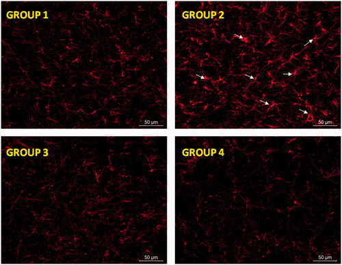 Figure 5. Glial activation induced by RT at the level of substantia nigra was prevented by RP as assessed by GFAP immunohistochemistry. Representative fluorescence micrographs of coronal brain slices at the level of the substantia nigra from all animal groups assayed (G1–G4). Arrow heads point to aberrant cell structures. G1: control group; G2: RT-treated control group; G3: RP-loaded PLGA nanoparticles and G4: RP in saline. RT: rotenone; RP: ropinirole.