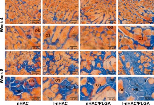 Figure 6 Histological evaluation of bone formation in mandible bone defects at the fourth and eighth week by Goldner’s trichrome staining.Abbreviations: NB, mineralized bone; nHAC, nano-hydroxyapatite/collagen; OS, osteoid; PLGA, poly lactic-co-glycolic-acid; S, composite scaffold.