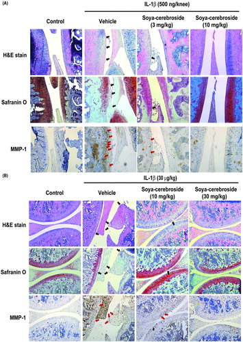 Figure 6. Soya-cerebroside reverses IL-1β-promoted MMP-1 production and cartilage degradation in animal models. Rats (A) or mice (B) were injected intra-articularly with IL-1β or saline as a negative control and then administered intra-peritoneal injections of saline or soya-cerebroside daily for 35 (A) or 7 days (B) (Liu et al., Citation2017). Photomicrographs of knee joint sections were stained with H&E or Safranin-O (black arrows) and immunostained with MMP-1 (red arrows).