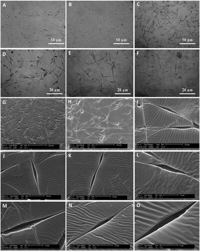 Figure 3. Optical microscopy images and SEM micrographs of SCs-imprinted PDMS substrates which biomimic SC morphology. SCs (A), optical imaging of SCs-imprinted patterns on PDMS substrate (B–F), SEM imaging of SCs-imprinted patterns on PDMS substrate (G–O). As seen in the SEM micrographs, cell templates obtained on the imprinted substrate simulate the specific topography of the SC shape.