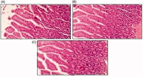 Figure 11. Histological slides of small intestine of rabbit of control group I (A), after oral solution of 5-FU-MMWCH-NPs treated group II (B) and 5-FU-MMWCH-NPs treated group III (C).