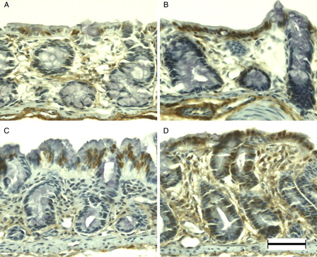 Figure 7. APE1 immunohistochemistry of DSS-induced colitis in young rats. APE1 was immunopositive at the surface epithelium in the colon of young rats (A). Immunoreactivity increased primarily in the surface epithelium at DSS-3d (B) and DSS-5d (C). APE1 was immunolocalized in the normal and slightly dysplastic mucosa at DSS-7d (D). Scale bar = 50 µm.