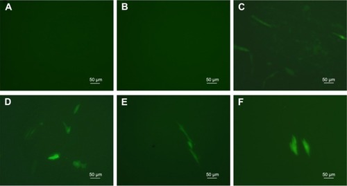 Figure 8 Observation of human umbilical cord mesenchymal stem cells transfected with plasmid GFP (pGFP).Notes: (A) Free pGFP; (B) untreated cells (blank control); (C) Lipofectamine 2000–plasmid Wnt3a (pWnt3a); (D–F) cationized Porphyra yezoensis polysaccharide-pWnt3a nanoparticles prepared at 40:1, 80:1, and 100:1, respectively.