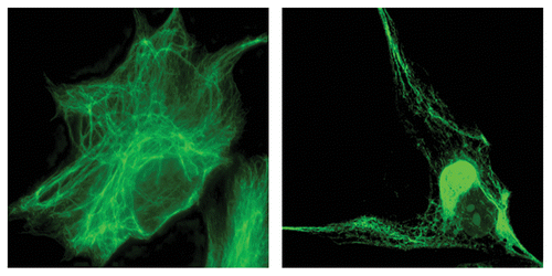 Figure 1. Left: A control fibroblast from an unaffected individual shows the well-dispersed IF network and the absence of aggregates. Right: A GAN patient fibroblast showing perinuclear vimentin IF aggregation.