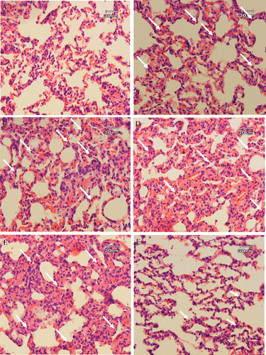 Figure 2.  Histopathological studies. Light microscopy showing histologic sections of lung of rats from different groups. (A) Section of lung from a rat receiving laparotomy plus ethanol 30% as vehicle (sham-operated, SOP group), (B) Section of lung from a rat receiving CLP plus ethanol 30% as vehicle (CLP group), (C) Section of lung from a rat receiving CLP + 2.5 mg/kg b.w. of STW 5, (D) Section of lung from a rat receiving CLP + 5 mg/kg b.w. of STW 5 and (E) Section of lung from a rat receiving CLP + 10 mg/kg b.w. of STW 5. Arrows indicate the infiltration or sequestration of polymorphonuclear neutrophils. Sections were stained with hematoxylin and eosin (original magnification ×400).