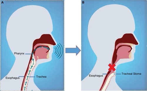 Figure 1 Voice production.