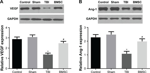 Figure 4 BMSCs transplantation upregulated expression of VEGF and Ang-1 in brain tissues of TBI mice. The protein and mRNA levels of (A) VEGF and (B) Ang-1 were detected by Western blot and qRT-PCR, respectively. GAPDH served as the control. *P<0.05: Sham vs TBI, #P<0.05: BMSC vs TBI.