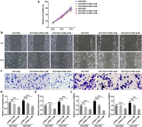 Figure 3. Inhibition of ER stress inhibits cell viability, migration and invasion in HCC1937 and HCC1954 cells. 2 mM or 5 mM of 4-PBA was added to inhibit the process of ER stress. (a) Cell viability was detected by CCK-8 assay. *P < 0.05 versus HCC1954. #P < 0.05 versus HCC1937. (b) and (d), Wound healing assay was performed to assess cell migration. Original magnification 100 ×. (c) and (e), Cell invasion was evaluated by transwell assay. Original magnification 100 ×. (f) Western blot assay was used to detect the levels of MMP2 and MMP9. Data are expressed as mean ± SD. **P < 0.01, ***P < 0.001.