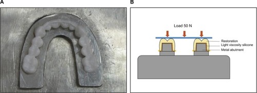 Figure 2 Measurement of internal accuracy of one-piece cross-arch prosthesis on a metal model (A) with an impression replica technique using light viscosity polyvinyl siloxane impression material to replicate the internal space (B).