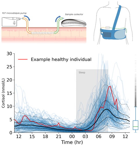 Figure 1. The U-RHYTHM microdialysis system and example data. Top left: Samples are collected using a linear microdialysis catheter placed superficially in abdominal subcutaneous tissue. The samples are fractionated and stored in the sample collector. Top right: the system is body worn and allows most normal activities to continue during the sampling period. Bottom: Data from a single volunteer (red line) and their sleep period (grey shaded area) are shown against the background variation of 214 healthy controls (blue lines) with interquartile range (bold is 50th centile, dashed lines 5th to 95th).