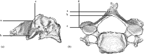 Figure 1. (a) Posterior view of vertebra. Point a represents the superior limit of the lateral mass and point b represents the inferior limit of the lateral mass. The distance between a and b was made to be 1 cm or greater to provide stability. (b) Superior view of vertebra. Point a represents the maximum height of the template, corresponding to the inferior intersection of the laminas, and point b represents the minimum height of the template, corresponding to the superior intersection of the laminas. Point c represents the bottom surface of the template and is slightly anterior to the transverse process. Line d represents the lateral margin of the drill template.