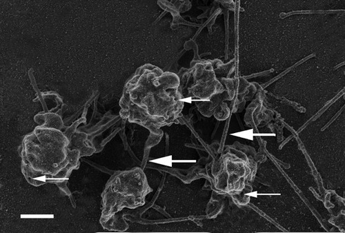 Figure 2. Platelet rich plasma from a citrated whole blood sample recalcified with addition of 0·2M CaCl2. Thick, white arrows = fibrin fibers associated with platelets; thin, white arrows = open canalicular membrane pores. Scale = 1 μm.