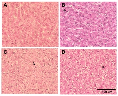 Figure 3 Cerium oxide nanoparticle exposure alters histopathological architecture of the liver. (A) Saline control (400×), (B) CeO2 at 1.0 mg/kg (400×), (C) CeO2 3.5 mg/kg (400×), and (D) CeO2 7.0 mg/kg (400×). Note evidence of hydropic degeneration (arrow) with CeO2 instillation.