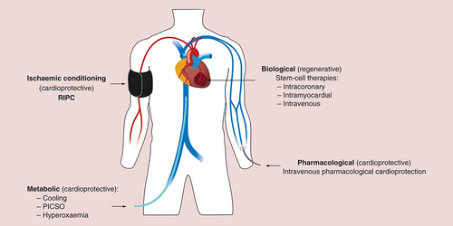 Figure 1. Overview of novel therapeutic strategies.RIPC: Remote ischemic preconditioning; PICSO: Pressure-controlled intermittent coronary sinus occlusion.