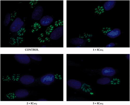 Figure 5. Representative images from Toxoplasma tachyzoites invasion assay. T. gondii tachyzoites were pre-incubated for 3 h with 20b or culture medium alone (control group/untreated group). Then, the cell monolayers were rinsed and incubated in the treatment-free medium for a further 24 h. Untreated parasites (control group) were considered as 100% of invasion. T. gondii – green; cell nuclei – blue.