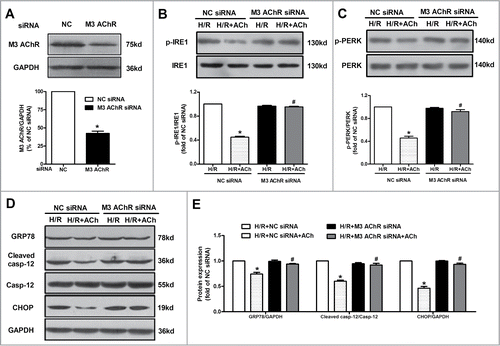 Figure 6. Knockdown of M3 AChR blocked the effects of ACh during H/R. (A) The silencing efficiency of M3 AChR siRNA. Cells were transfected with siRNA followed by H/R. The expression changes of p-IRE1/IRE1 (B) and p-PERK/PERK (C) were determined after M3 AChR/NC siRNA with or without ACh. (D and E) Representative immunoblots and quantitative analysis of GRP78, cleaved caspase-12 and CHOP after M3 AChR/NC siRNA with or without ACh. The data expressed as mean ± SEM in each bar graph represent the average of 4 independent experiments. *P < 0.01 vs NC siRNA group. #P < 0.01 vs ACh-treated NC siRNA group.