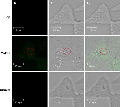 Figure 5 Laser scanning confocal microscopic images of the live cell treated with lys-NDs for 24 hours.Notes: (A) Fluorescence images, (B) brightfield images, and (C) overlay of fluorescence and brightfield images. Excitation was performed using a 476 nm wavelength laser source, and emission was collected from 492 nm to 677 nm wavelengths. A total of 44 slices were imaged with 0.38 µm intervals. Top, middle and bottom represents the z-positions of the sections analyzed being 44th, 22nd and 1st section, respectively. Red circles highlight the presence of lys-NDs in the cellular cytoplasm.Abbreviations: lys-NDs, lysine-functionalized NDs; NDs, nanodiamonds.