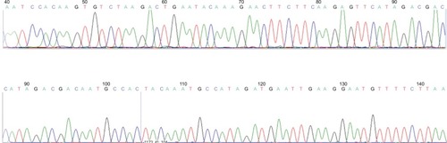 Figure 3 Sequences of hMAM gene in PCR positive.
