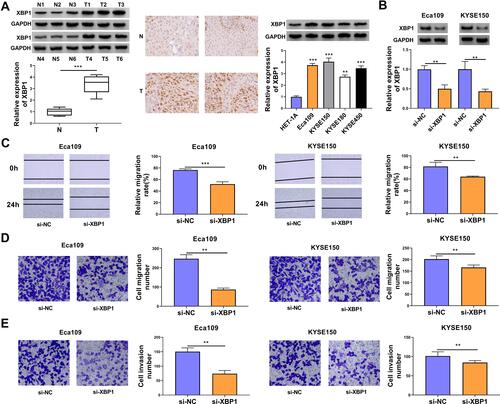 Figure 1 XBP1 interference restrains cell migration and invasion abilities of ESCC cells. (A) The relative protein expression of XBP1 was determined in ESCC tumor specimens and paired non-tumor specimens by Western blot assay and IHC assay. The relative level of XBP1 protein was examined in a panel of four ESCC cell lines (Eca109, KYSE150, KYSE180 and KYSE450) and normal esophageal cell line HET-1A by Western blot assay. (B–E) Eca109 and KYSE150 cells were transfected with si-NC or si-XBP1. (B) The protein expression of XBP1 was determined by Western blot assay. (C) Wound healing assay was performed to analyze the relative migration rate of transfected ESCC cells. (D) Transwell migration assay was conducted to analyze the number of migrated cells to assess cell migration ability. (E) Cell invasion number was analyzed in transwell invasion assay to assess cell invasion ability. **P<0.01, ***P<0.001.