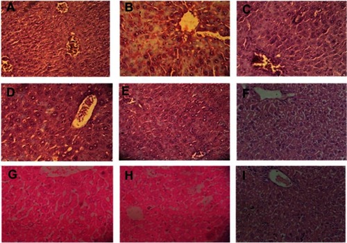 Figure 4 Livers of mice were dissected (after they were euthanized at the end of the experiment), fixed, stained with H&E, and observed at 40× magnification. (A) Normal, (B) control, (C) CCl4+LD PE, (D) CCl4+MD PE, (E) CCl4+HD PE, (F) CCl4+LD AgNPs, (G) CCl4+MD AgNPs, (H) CCl4+HD AgNPs, (I) CCl4+silymarin.Abbreviations: CCl4, carbon tetrachloride; LD, low dose; PE, plant extract; MD, medium dose; HD, high dose; AgNPs, silver nanoparticles.