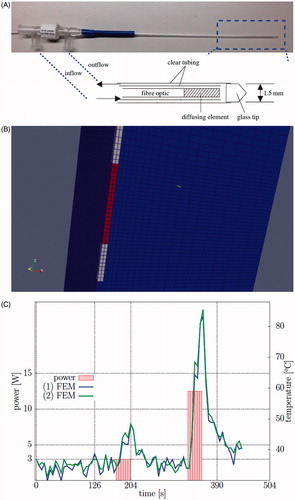 Figure 1. (A) The Visualase® applicator modelled in this application and a diagram of the photon emitting diffusing tip and the cooling fluid are shown. (B) A finite element mesh conforms to the applicator and is used as the template for the calculations. (C) A representative time–temperature history profile is shown of the thermometry data at two points within the brain tissue, ∼1 mm from the applicator. The corresponding power history is also shown.