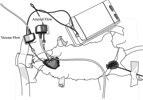 Figure 1. Ultrasound Transit Flow Probes. A constant flow of 10 ml/min extracts blood from the carotid artery and returns it into the jugular vein. Saline injections into the venous line lowers blood density, which is detected by the venous flow probe and triggers automatic cardiac output measurement (Original Drawing).