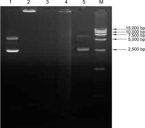 Figure 3 Stability analysis of the plasmid DNA after encapsulation in the chitosan nanoparticles.Notes: Lane1: untreated naked plasmid pVAX I-optiF; Lane 2: untreated chitosan encapsulated plasmid DNA; Lane 3: naked plasmid pVAX I-optiF treated by DNase I; Lane 4: pFNDV-CS-NPs treated by DNase I; Lane 5: pFNDV-CS-NPs treated by DNase I and chitosanase; M: DNA marker DL 15000.Abbreviations: DNA, deoxyribonucleic acid; pFNDV-CS-NPs, Newcastle disease virus F gene encapsulated in chitosan nanoparticles; pVAX I-optiF, eukaryotic expression plasmids.