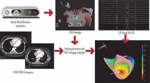 Figure 3. VIVO workflow. In step one creation of patient-specific heart and torso model from MRI or CT (DICOM images). Step two is determining patient-specific electrode positions from 3D image acquired using the Intel RealSense camera, by merging the torso model and 3D image. In the next step, the 12-lead ECG is imported, and a single arrhythmia beat is analyzed. The white arrow is pointed toward the earliest activation site.