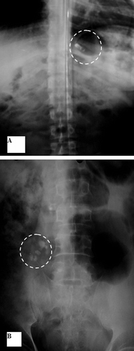 Figure 7.  Localization of F2 throughout the GIT: A- Stomach after 20 min. B- Transverse colon after 3 hrs.