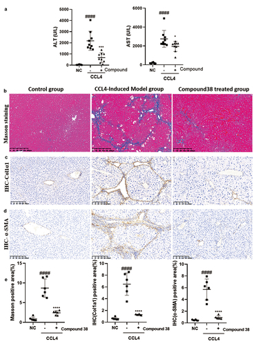 Figure 5. Compound 38 treatment reduces liver inflammation and fibrosis.