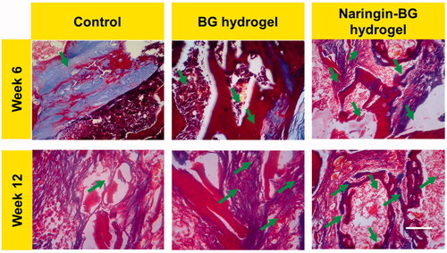 Figure 10. MTS-stained damaged tissue sections from 6 and 12 weeks surgery after treatment with control, BG hydrogel, and Naringin–BG hydrogel groups. Scale bar 100 µm.