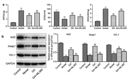 Figure 6. The protective effect of GA on oxidative stress of WAS tissues was abolished by ML385. A. The concentration of MDA, SOD, and GSH was determined by ELISA assay. B. The expression of Nrf2, Keap1, and HO-1 was determined by Western blotting assay (**p < 0.01 vs. Control, ##p < 0.01 vs. Model, &p < 0.05 vs. GA, &&p < 0.01 vs. GA)