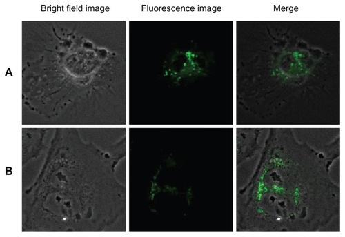 Figure 13 Imaging of (A) human umbilical vein endothelial cells and (B) glioma cells using silica-coated cadmium sulfide quantum dots after 2 hours of incubation.
