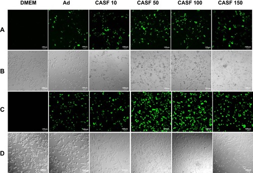 Figure 6 The laser confocal fluorescence images of SMMC-7721 and L-02 cells cultured with DMEM, Ad and CASF/Ad complex for 24 h. (A) Fluorescence field and (B) bright-field images of SMMC-7721 cells; (C) fluorescence field and (D) bright-field images of L-02 cells. Scale bar: 100 μm. CASF 10 to CASF 150 represented cells were infected with the CASF/Ad complexes formed by coating Ad with CASF at concentrations of 10, 50, 100 and 150 μg/mL, respectively.Abbreviations: DMEM, Dulbecco’s modified Eagle medium; CASF, cationic Antheraea pernyi silk fibroin; Ad, adenovirus.