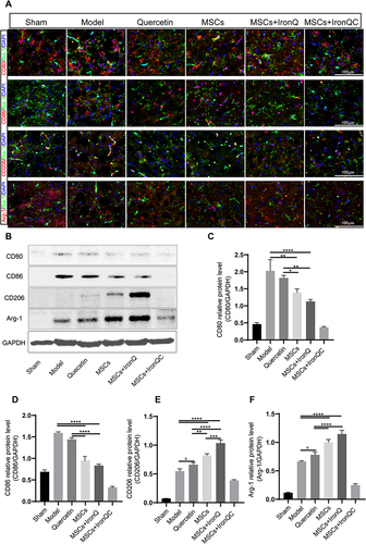 Figure 6 Pretreated MSCs with IronQ enhanced the transformation of the M2 microglial neuroprotective phenotype. (A) Representative double immunofluorescent staining of polarization marker/Iba-1 in ipsilateral basal ganglia of mice after ICH (n = 5 per group). Scale bar = 100 μm. (B–F) The results of Western blot in different groups revealed the protein expression levels of microglial polarization markers in mice brain tissue (n = 5 per group; *P < 0.05, ** p< 0.01, ***p< 0.001, and ****P < 0.0001).