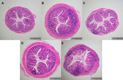 Figure 4 Morphological observation of colon. The asterisk, black arrow and yellow arrow in the picture respectively indicates interstitial lymphocyte infiltration, villous defect, and the crypt structural changes. (A): C-G, (B): DSS-G, (C): LA-G, (D): SSZ-G, (E): BB-G. Scale bar: 50 μm.
