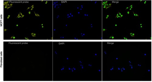 Figure 3 In vitro imaging of MCF7 cells using CaCO3 nanoprobe. The upper row shows MCF7 cells incubated with nanoprobe for 30 mins. The second row shows fibroblast cells incubated with nanoprobe for 24 hrs.