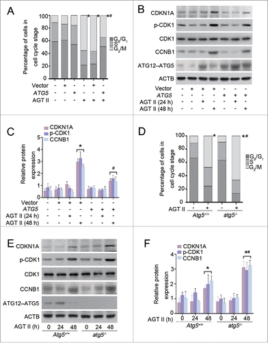 Figure 9. Overexpression of ATG5 attenuates AGT II-induced G2/M cell cycle arrest in HK-2 cells and primary TECs. (A) HK-2 cells were transiently transfected with either pcDNA3.1-ATG5 or pcDNA3.1-HA vector followed by treatment with 10−6 mol/L of AGT II for 48 h, and then cell cycle distribution was analyzed by flow cytometry. Data are means ± SEM (n = 3); *, P < 0.01 vs. AGT II-untreated cells; #, P < 0.05 vs. AGT II-treated cells without ATG5 overexpression. Symbols indicate the fraction of G2/M phase cells. (B) HK-2 cells were treated as described above. Expression of CDKN1A/p21, p-CDK1, and CCNB1 (cyclin B1) was examined by immunoblot. (C) Protein levels were quantified with scanning densitometry and standardized to ACTB. Data are expressed as mean ± SEM (n = 3); *, P < 0.01 vs. control or cells treated with AGT II for 24 h; #, P <0.05 vs. cells treated with AGT II for 48 h without ATG5 overexpression. (D) Primary renal proximal TECs from Atg5+/+ and atg5−/− mice were stimulated with 10−6 mol/L of AGT II for 48 h. Cell cycle distribution was assessed by flow cytometry. Data are expressed as mean ± SEM (n = 3); *, P < 0.01 vs. respective control; #, P < 0.05 vs. AGT II-treated cells from Atg5+/+ mice. Symbols indicate the fraction of G2/M phase cells. (E) Primary renal proximal TECs were treated as described in Figure 5D. Protein expression was detected by immunoblotting. (F) The expression of CDKN1A/p21, p-CDK1, and CCNB1 was quantitatively analyzed using a densitometer. Values are mean ± SEM (n = 3); *, P < 0.05 vs. respective control or cells treated with AGT II for 24 h; #, P < 0.05 vs. cells from Atg5+/+ mice treated with AGT II for 48 h.
