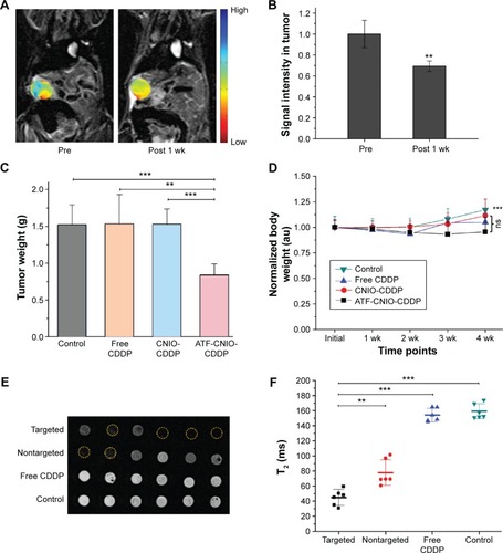 Figure 3 Treatment efficacy of ATF-CNIO-CDDP in the orthotopic pancreatic tumor model evaluated by MRI.Notes: (A) In vivo T2-weighted MRI of a mouse bearing orthotopic pancreatic tumor, overlapped with T2 mapping MRI of tumor, before and 1 week after the treatment. (B) Corresponding quantitative MR signal changes. Data are presented as mean ± SD (n=3). (C) Comparison of the averaged tumor weights from different treatment groups (n=6) showed the significant inhibition of the tumor growth by ATF-CNIO-CDDP (P<0.01) after once-weekly IV administration for 4 weeks, and (D) the changes of relative body weight over the treatment course. (E) Ex vivo T2-weighted MR images of tumors collected from mice after the 4-week treatment, and (F) the corresponding T2 relaxation time measured by MRI. **P<0.01, ***P<0.001.Abbreviations: ATF, amino-terminal fragment; au, absorbance unit; CDDP, cisplatin; CNIO, milk protein (casein)-coated magnetic iron oxide; IV, intravenous; MRI, magnetic resonance imaging; ns, nonsignificant; SD, standard deviation; wk, week.