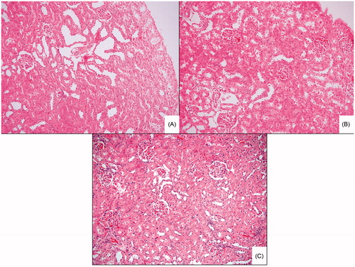Figure 1. Light microscopic examination of the kidneys. Figure A shows the kidney of control group. There was mild to moderate glomerular congestion, and severe tubular injury in SWT group (B). Tubular structures were preserved in the kidneys of SWT + 1400W groups (C) compared with the SWT group.