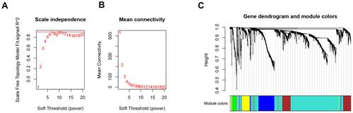 Figure 2 Choosing a suitable β value to construct a hierarchical clustering tree. (A) shows the scale-free fit index for the analysis of the soft threshold of 1‒20. (B) shows the analysis of the average connectivity of the 1‒20 soft threshold. (C) shows that genes were divided into different modules through hierarchical clustering, where different colors represent different modules.