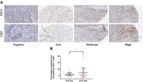 Figure 6 Association between STC1 and CD3+ T cells infiltration level. (A) Representative IHC images showing BLCA samples immunostained for STC1 and CD3. (B) Different density of CD3+ T cells infiltration according to STC1 levels. *P value < 0.05.