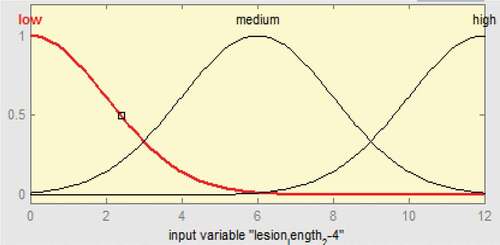 Figure 19. Membership functions of 2 mm ≤ ulcer length ≤ 4 mm