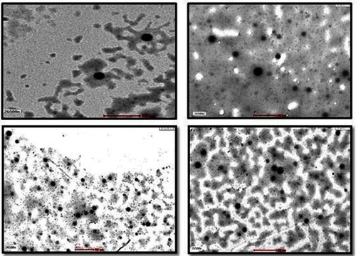 Figure 2 TEM images of BBP-encapsulated PLGA-b-PEG nanoparticles at a magnification of 500 nm. The scale bar or magnification is 40×.Abbreviations: TEM, transmission electron microscope; BBP, 3,5-bis[4-(diethoxymethyl)benzylidene]-1-methyl-piperidin-4-one; PLGA-b-PEG, polylactic-co-glycolic acid-block-polyethylene glycol.