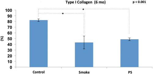 Figure 10. Immunohistochemical assessment of type I collagen fibers among the groups at 6 months of follow-up (C6, S6 and PS). Statistical analyses were performed with one-way ANOVA test. Results are presented as an average percentage of type I collagen in relation to the total area of ​​the trabeculae. The data are shown as mean and standard deviation (Control: 6 mo, n = 7. Smoke: 6 mo, n = 10. PS: n = 4). PS: provisional smoke. mo: month. *Statistically significant difference present in the Bonferroni post-test.