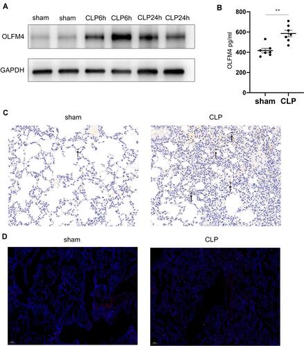 Figure 4 OLFM4 expression was increased in CLP-induced lung injury. (A). OLFM4 protein expression in CLP-induced lung injury at 6 h and 24 h was detected by Western blot. (B). OLFM4 expression in the BALF of sham mice and CLP mice was measured by ELISA. Data are presented as mean ± SEM (n = 7). **p < 0.01. (C and D). OLFM4 expression in the lungs of sham mice and CLP mice was detected by immunohistochemical staining and immunofluorescence staining. OLFM4 was stained red, and nuclei was stained with DAPI in IF images.