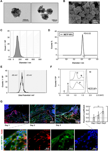 Figure 2 Characterization and in vivo colocalization of METP NPs. NPs were characterized (A and B) by TEM and SEM imaging of the particle size and morphology of METP NPs in PBS and in powder form, respectively. (C) Particle size analysis by NTA. (D) Particle size, polydispersity and PDI index analyses by DLS. (E) Zeta potential analysis. (F) Energy spectrum according to EDS describing the composition of elements in METP NPs. (G) Immunofluorescence colocalization images of macrophages (red) and METP NPs (green) in joint tissue sampled on Days 1, 2 and 3 after intracellular injection. Cell nuclei are labeled with DAPI. keV, kilo electron volt; C, N, O, Si and P for carbon, nitrogen, oxygen, silicon and phosphorus respectively. Data are presented as the mean ± SD. **P < 0.01.