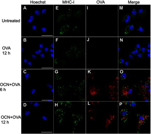 Figure 9 OVA delivered by OCNs colocalized with MHC-I containing compartments. OCN+OVA (ratio 3:1 ratio) were incubated with BMDMs. After the indicated incubation times at 37°C, cells were subjected to immunofluorescence staining using biotin conjugated anti-mouse H2Dd antibody and DyLight 488 conjugated streptavidin for MHC-I staining (green). OVA were detected using rabbit polyclonal anti-OVA antibody and anti-rabbit IgG antibody conjugated with Alexa Fluor® 555 (red). Nuclei were stained with Hoechst (blue). Images were acquired by confocal microscopy. (A–D) Hoechst, (E–H) MHC-I, (I–L) OVA and (M–P) the merged images. Arrow heads indicate colocalization between OVA and MHC-I (yellow). Scale bar =20 µm.
