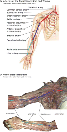 Figure 3. Corresponding (a) textbook (From Marieb EN: Human Anatomy & Physiology, San Francisco, 2001, Benjamin Cummings, used by permission of Pearson Education, Inc.) and (b) cadaver roll-over images of the right upper limb and thorax highlighted to allow the arterial pathway of blood flow to the wrist to be followed.